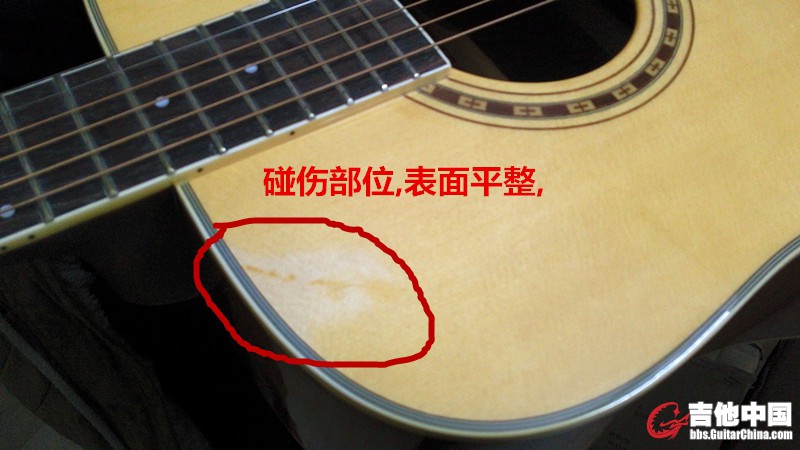 碰伤部位1_副本.jpg